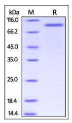 Human Her2 (23-450), Fc Tag on SDS-PAGE under reducing (R) condition. The gel was stained overnight with Coomassie Blue. The purity of the protein is greater than 95%.